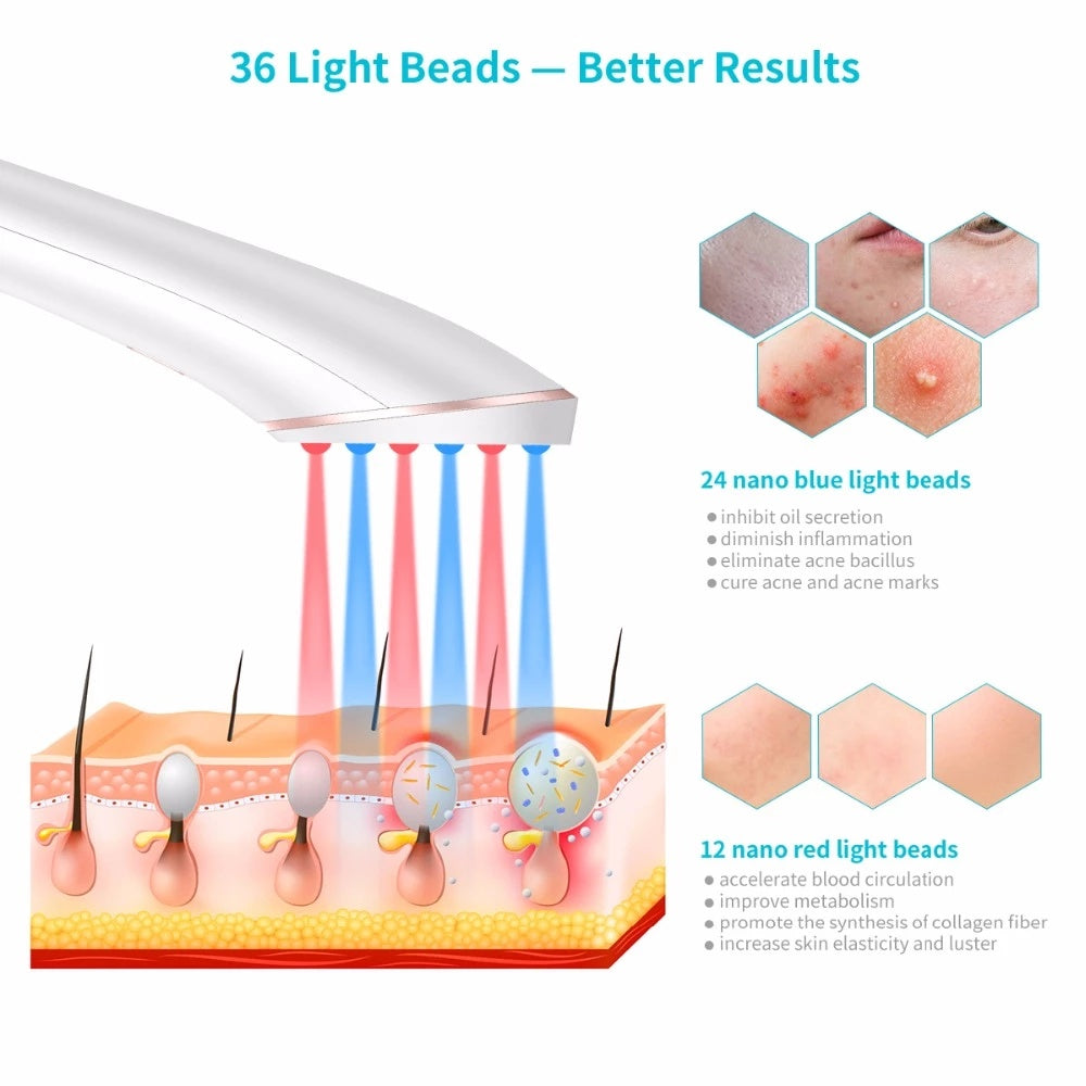 Wireless Acne Light Therapy Device – Red & Blue LED Treatment for Clear Skin